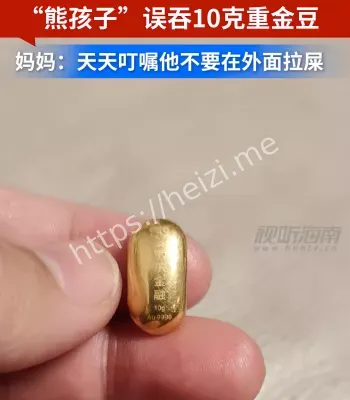 男童误吞10克金豆